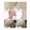 Image of Skin Whitening Cream - Aichun™ Armpit, Legs, Knees and Private Parts